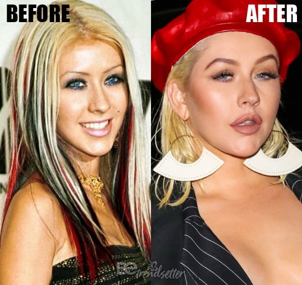 Christina Aguilera Lippenunterspritzung