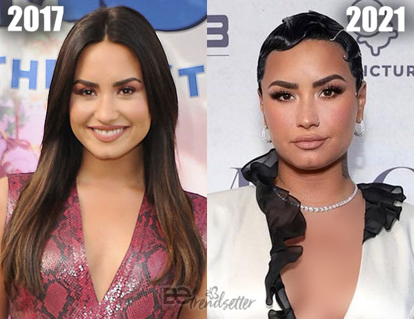 Demi Lovato Face 2017 2021