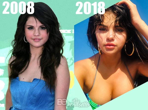 Selena Gomez Plastic Surgery 2008 - 2018
