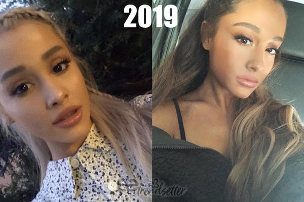 Ariana Grande lip fillers 2019