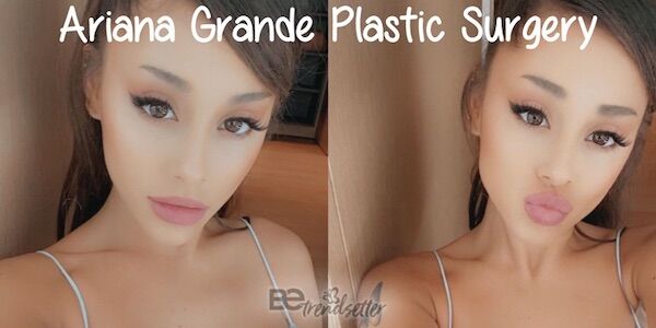 Ariana grande plastic surgery