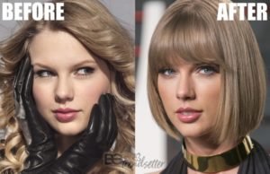 Taylor Swift Plastic Surgery Mystery SOLVED!