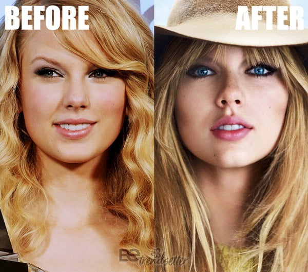 taylor swift before and after veneers