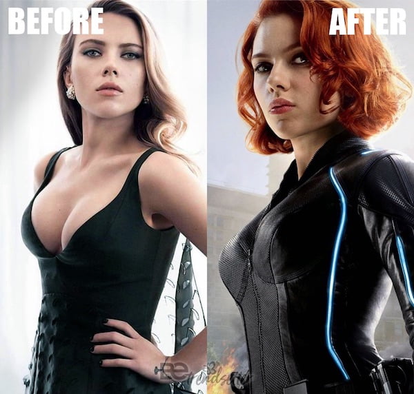 Scarlett Johansson Plastic Surgery Breast Reduction Before