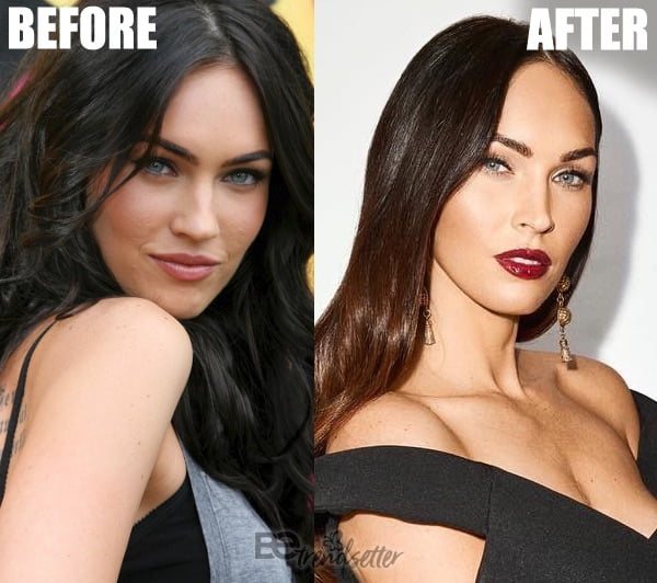 megan fox acne scars