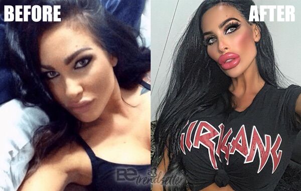 Tara Jayne Plastic Surgery