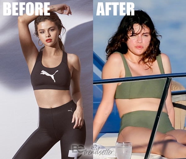 Selena Gomez Plastic Surgery 2020