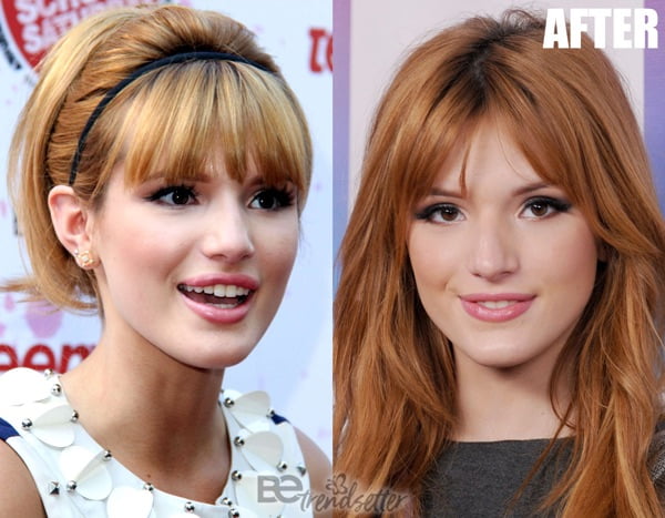 Bella Thorne lip filler 2013