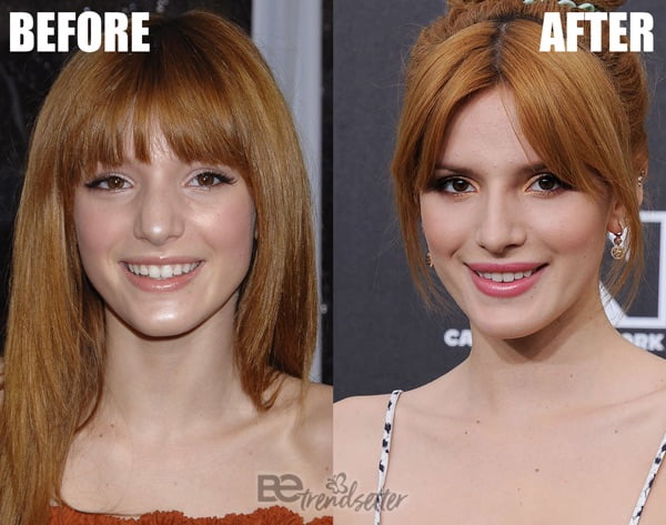 Bella Thorne Nose Job 2014