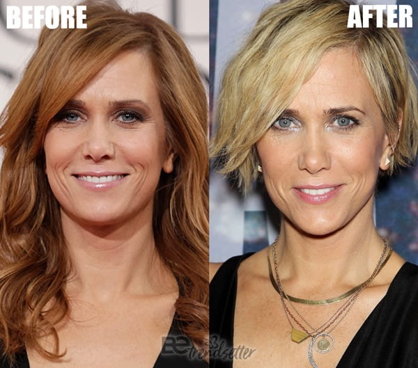 Kristen Wiig Face Lift