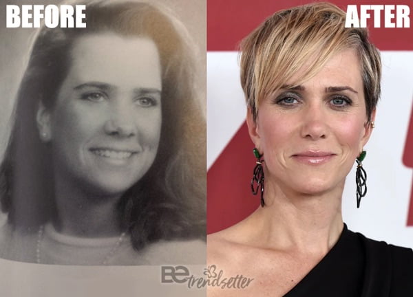 Kristen Wiig Nose Job Then and Now